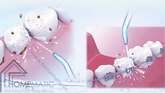 Dụng cụ vệ sinh răng miệng Oral Irrigator
